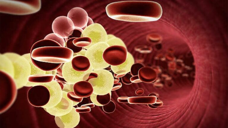 Shenjat që Trupi Jep të Cilat Paralajmërojnë se Duhet të Kontrolloni Kolesterolin në Gjak